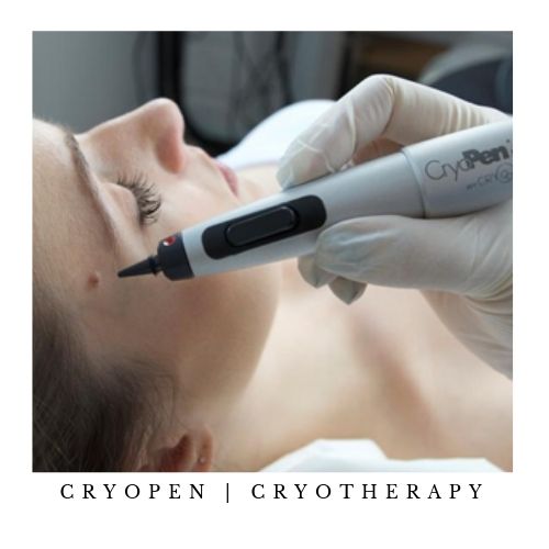cryotherapy-cryopen