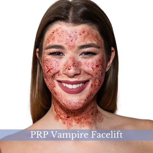 Portfolio-Vampire-Facelift1
