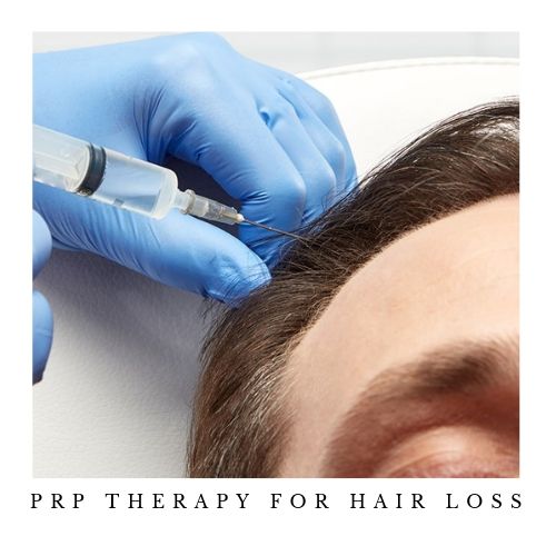 PRP Hair Loss - Featured Image
