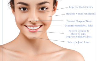 what-are-dermal-fillers-areas