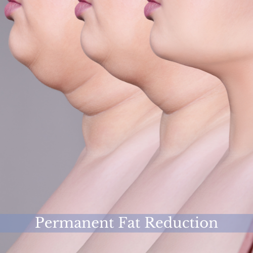 Permanent Fat Reduction 2 - Double Chin