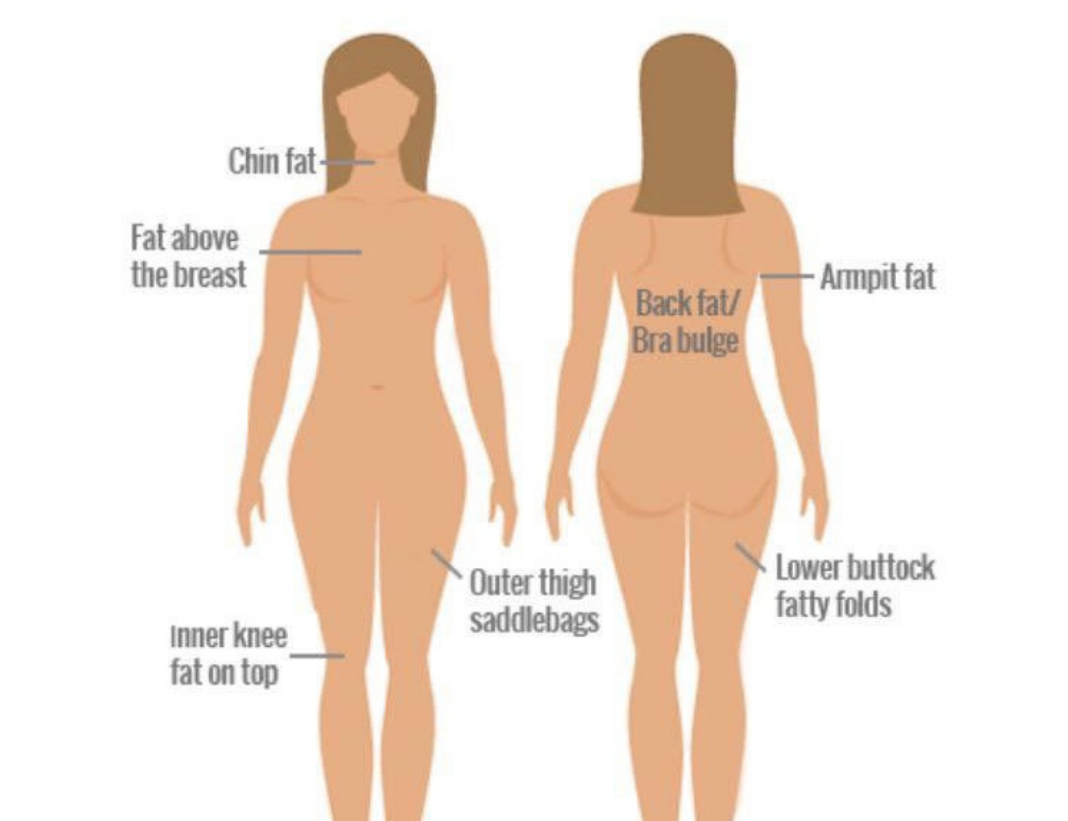 areas-body-fat-dissolve